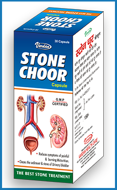 Stone Choor 30 Capsules | Vardan Healthcare