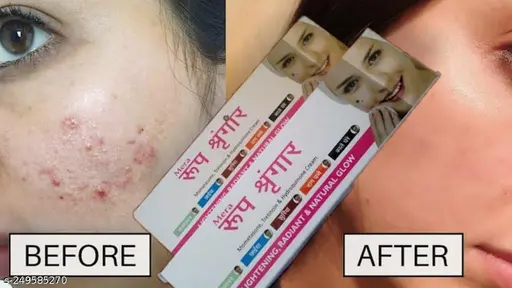 rup singar cream 20gm pack of 1pcs. [face whiting cream]