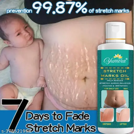 Yumora Safe Organic Stretch Mark Oil Mark Removal - Natural Heal Pregnancy Breast, , Legs, Made with Organic Ingredients -50 ml (Pack Of 1)