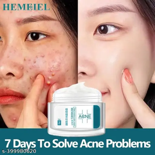 Pimple Marks Remover Cream / Differin Gel / Acne Scar Remover Cream 50 gm