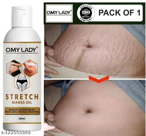 OMY LADY present Repair Stretch Marks Removal - Natural Heal Pregnancy Breast, , Legs, Mark oil 50 ml pack of 1